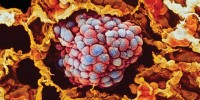 image: Epigenetic Changes in Cancer