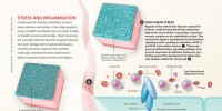image: Stress and Inflammation