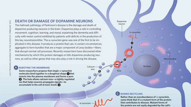 Death or Damage of Dopamine Neurons image: Death or Damage of Dopamine Neurons
