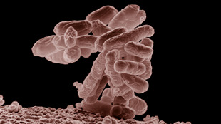 Deadly Trait Combo Arms German <em>E. coli</em> image: Deadly Trait Combo Arms German <em>E. coli</em>