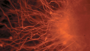 Embryonic Stem Cell Fight Continues image: Embryonic Stem Cell Fight Continues
