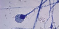 image: Bigger spores = badder infection