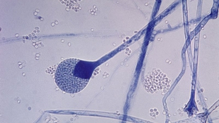 Bigger spores = badder infection image: Bigger spores = badder infection