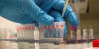 Stem Cells from Banked Blood image: Stem Cells from Banked Blood