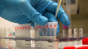 Stem Cells from Banked Blood image: Stem Cells from Banked Blood