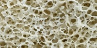 image: New and Improved Bone Tests