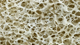 New and Improved Bone Tests image: New and Improved Bone Tests