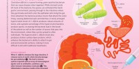 image: Anatomy of C. Difficile