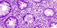 image: Top 7 in immunology