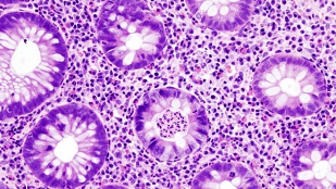 Top 7 in immunology image: Top 7 in immunology