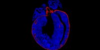 image: Repairing hearts