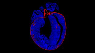 Repairing hearts image: Repairing hearts