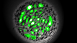 First biological laser image: First biological laser