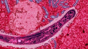 Malaria Pipeline Biggest Ever image: Malaria Pipeline Biggest Ever