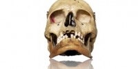 image: Gould's bias