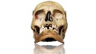 Gould's bias image: Gould's bias