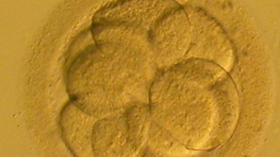 Embryos Right Genetic Wrongs? image: Embryos Right Genetic Wrongs?