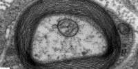 image: New Target for Myelin Repair