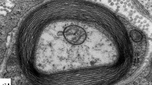 New Target for Myelin Repair image: New Target for Myelin Repair