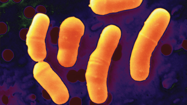 Probiotic Protection image: Probiotic Protection