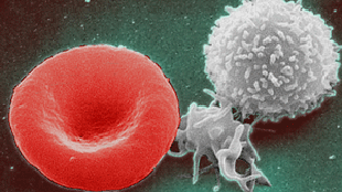 Stem Cells Hit Reverse image: Stem Cells Hit Reverse