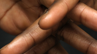 Digit ratio predicts penis length image: Digit ratio predicts penis length