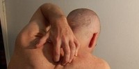 image: Contact Allergies May Help Stymie Cancer