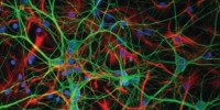 image: Brain Cells Self-Amplify