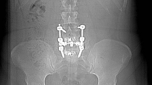 Medical Device Researchers Slanted Trials image: Medical Device Researchers Slanted Trials