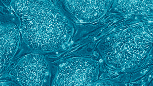 Stem Cell Approvals Are Up image: Stem Cell Approvals Are Up