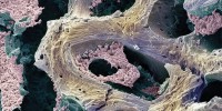 image: Interfering with Cancer