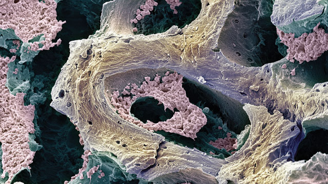Interfering with Cancer image: Interfering with Cancer
