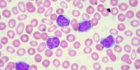 image: Turning T-cells into Cancer Killers