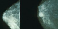 image: Cancer Researcher Fabricated Data