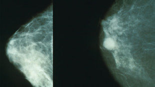 Cancer Researcher Fabricated Data image: Cancer Researcher Fabricated Data