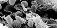 Black Death Pathogen Extinct? image: Black Death Pathogen Extinct?