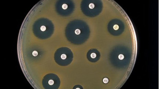 The Age-Old Fight Against Antibiotics image: The Age-Old Fight Against Antibiotics