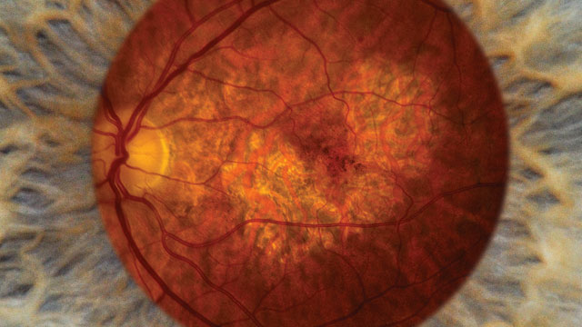 An Eyeful of RNA image: An Eyeful of RNA