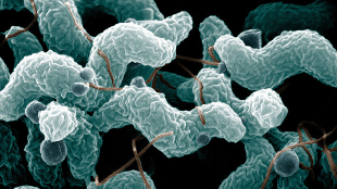 A digitally colorized scanning electron microscope image of Campylobacter jejuni