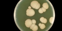 image: One Pathogen, Two Biofilms