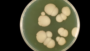 One Pathogen, Two Biofilms image: One Pathogen, Two Biofilms