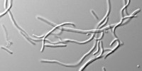 image: Rewriting <em>E. coli</em>’s Genetic Code
