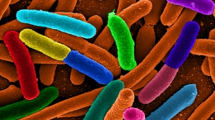 A digitally colorized micrograph image of E. coli