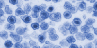 Chronic Fatigue Scientists Get Death Threats image: Chronic Fatigue Scientists Get Death Threats