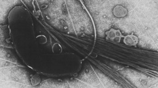 Haitian Cholera Source Confirmed image: Haitian Cholera Source Confirmed