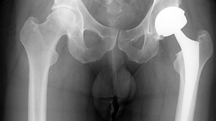 Tighter Devices Regulation Needed image: Tighter Devices Regulation Needed