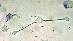 Top 7 in Immunology image: Top 7 in Immunology