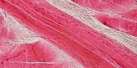 image: Velcro Helps Muscles Grow
