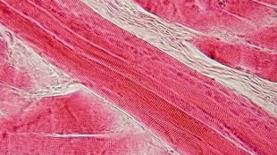 Velcro Helps Muscles Grow image: Velcro Helps Muscles Grow