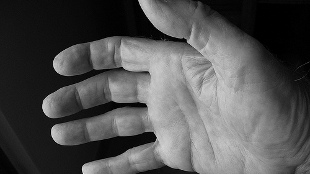 Digit Ratio and Sex Hormones image: Digit Ratio and Sex Hormones